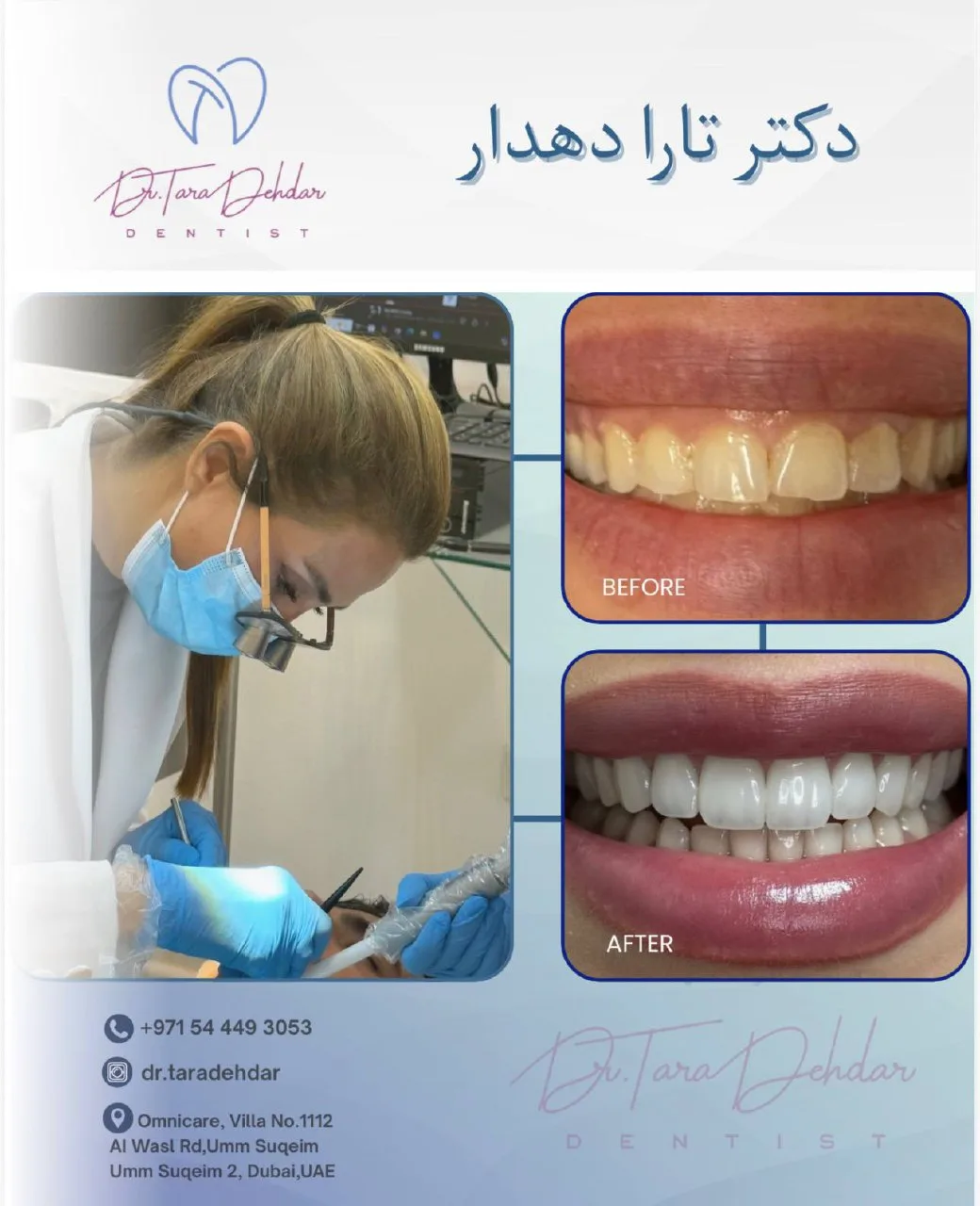 دندانپزشک زیبایی - دکتر تارا دهدار، دبی
